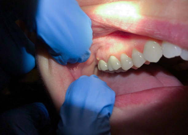 Best Emergency Dentist for Special Needs Patients in French Mp, CA