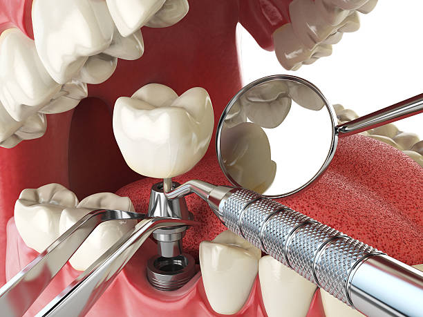 Best Emergency Dentist for Special Needs Patients in French Mp, CA