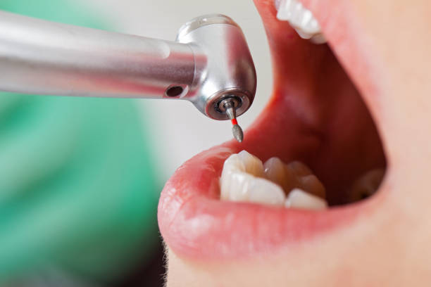 Best Pediatric Emergency Dentist in French Mp, CA